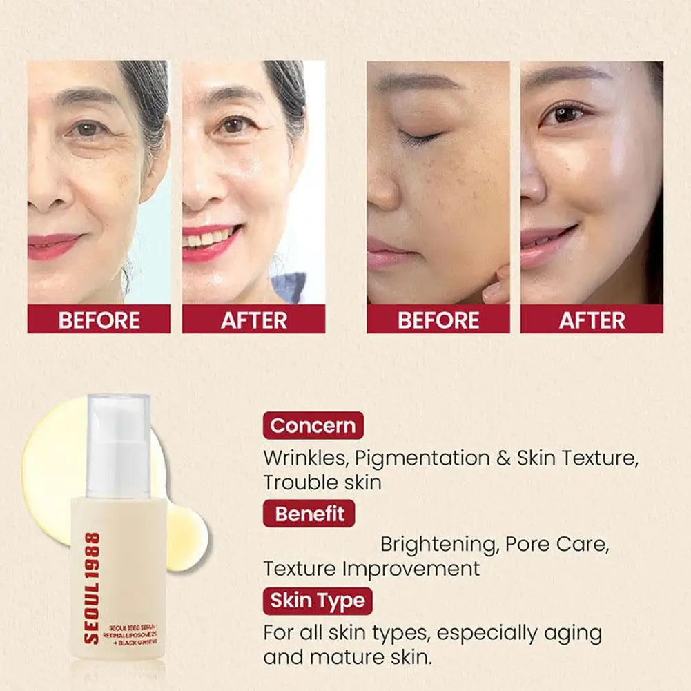 Korean SEOUL 1988 Skin Care Set - Retinol Eye Cream, Ginseng Niacinamide Serum, Cleanser