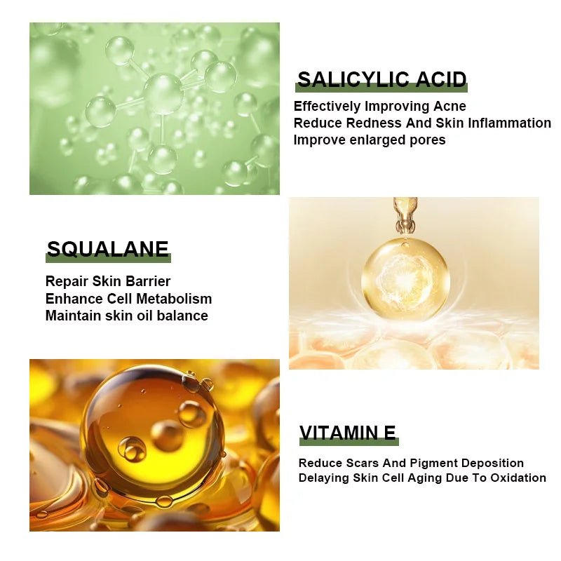 Anti-Acne Face Serum Salicylic Acid Acne Removing Brightening Korean Skin
