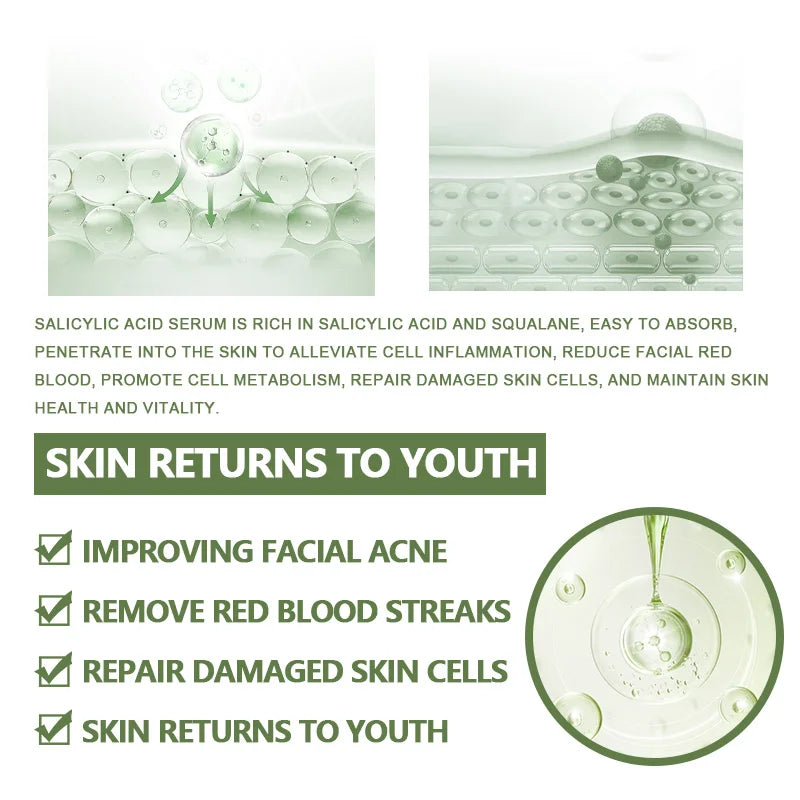 Anti-Acne Face Serum Salicylic Acid Acne Removing Brightening Korean Skin